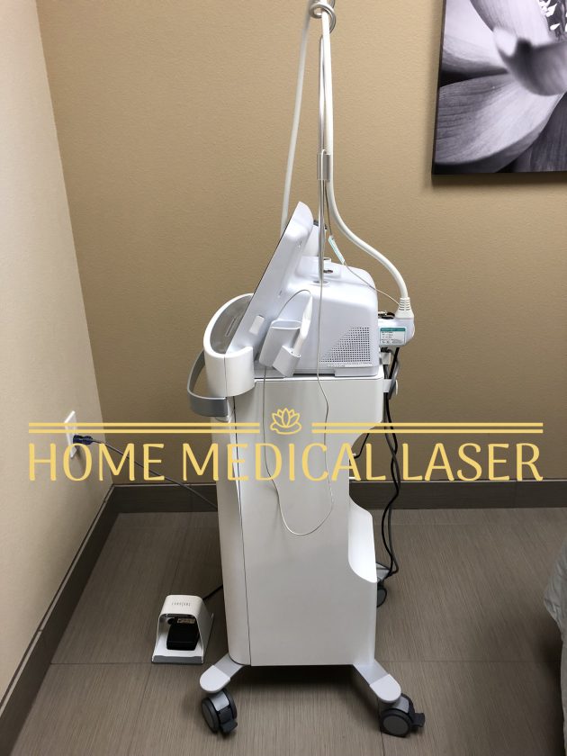 Cynosure Potenza Microneedling - Image 3