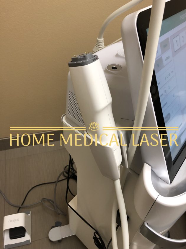 Cynosure Potenza Microneedling - Image 5