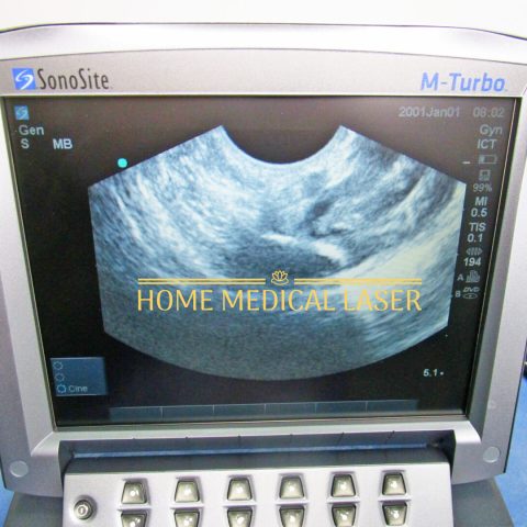 Sonosite M Turbo Ultrasound System