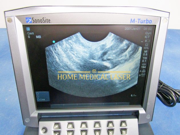 Sonosite M Turbo Ultrasound System