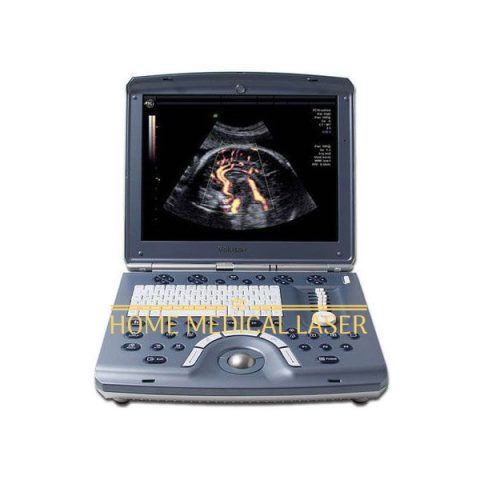 GE Voluson i Ultrasound Machine