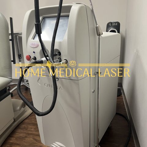 Candela VBeam Perfecta 595nm