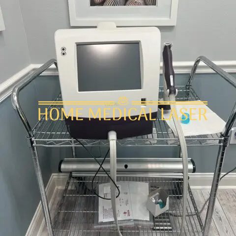 Viveve Monopolar RF Vaginal Rejuvenation