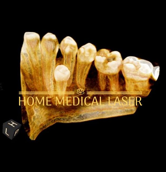 CARESTREAM CS 9000C 3D PANOREX + CEPH + CONE BEAM - Image 2