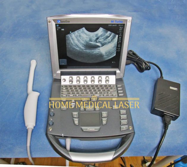 Sonosite M Turbo Ultrasound System - Image 4