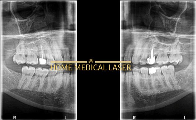 CARESTREAM CS 8200 3D PANOREX + CONE BEAM - Image 4