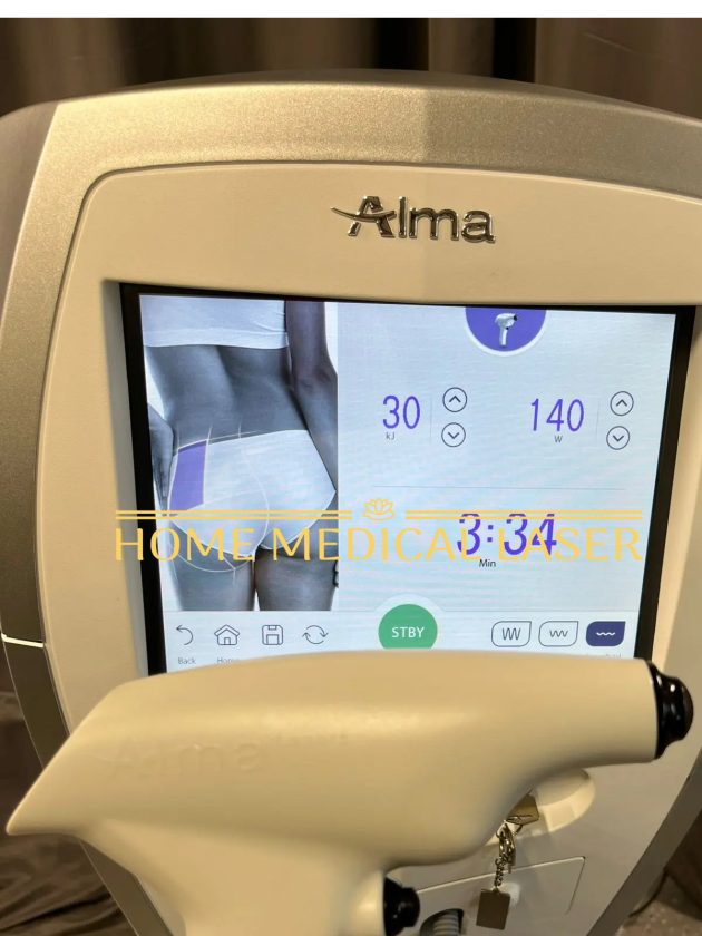 Alma Accent Prime RF Body Contouring - Image 5