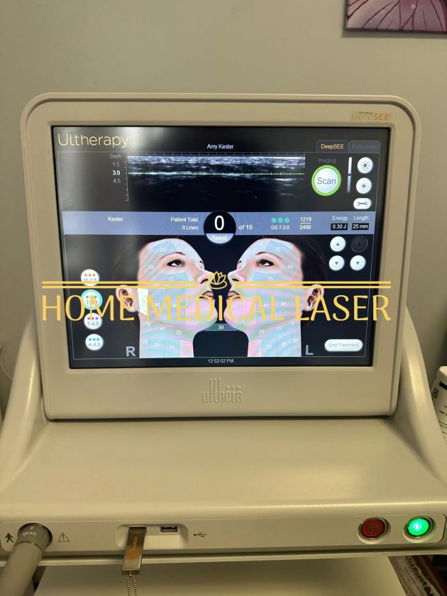 Ulthera Ultherapy Ultrasound Skin Tightening - Image 6