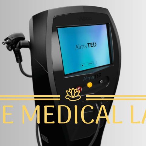 Alma Ted Hair Loss Treatment Laser